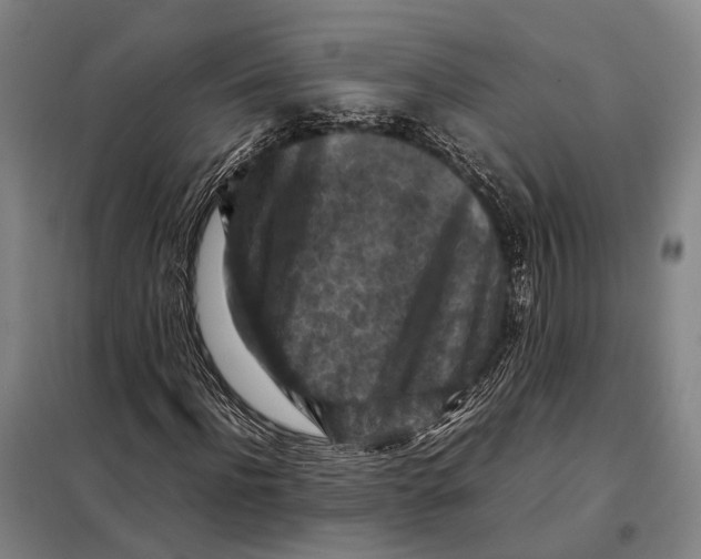 X0000097920916200804041520