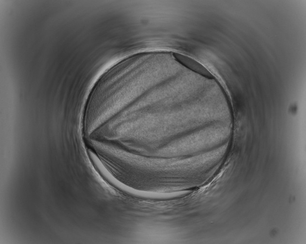 X0000097921197200804041517