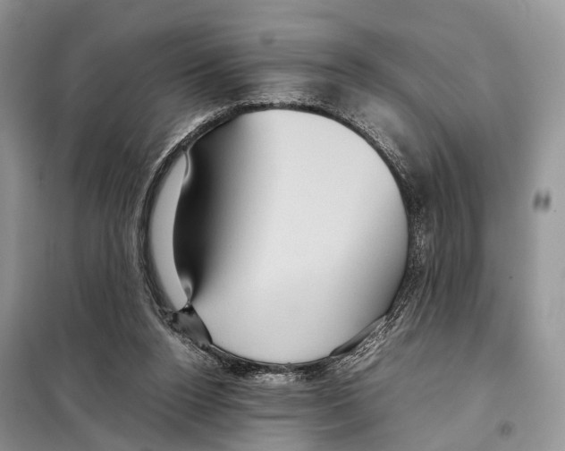 X0000097920160200804111149