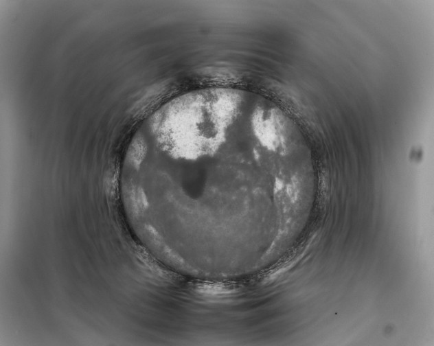 X0000097920177200804111149