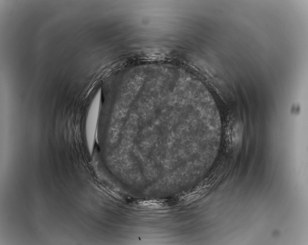 X0000097920516200804111143