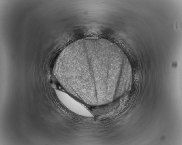 X0000097920617200804111141