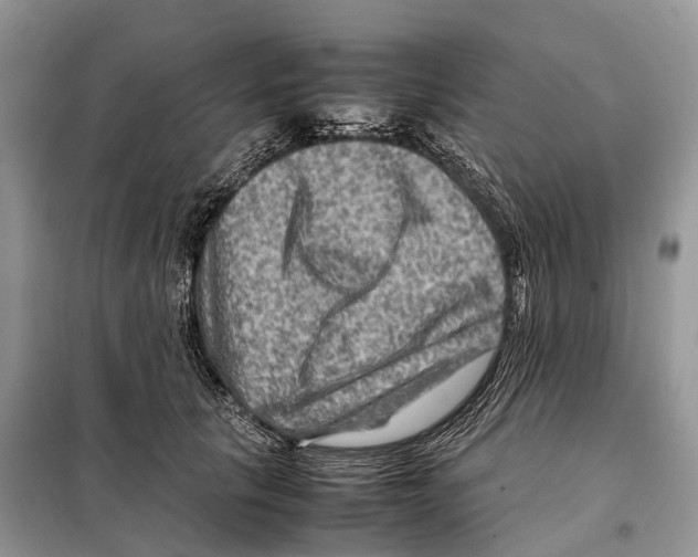 X0000097920657200804111141