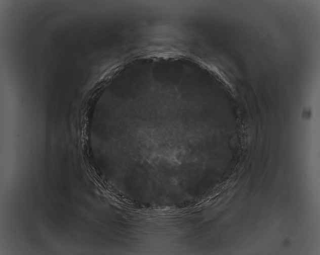 X0000097951399200804011623