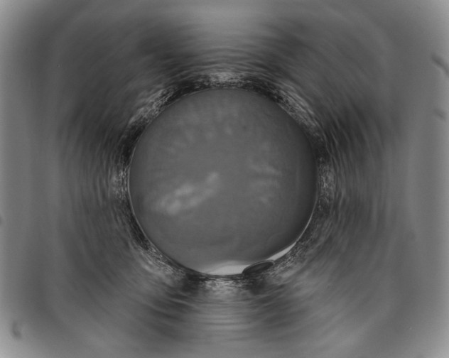 X0000097950419200804141008