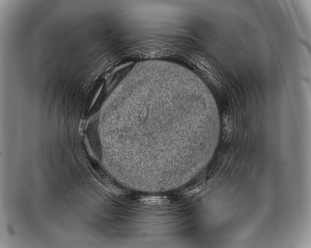 X0000097950499200804141007