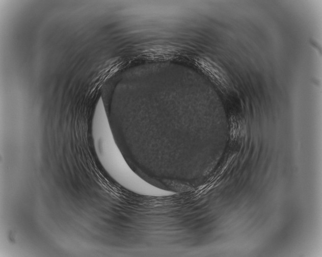 X0000097951108200804140956