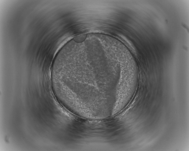 X0000097951198200804140955