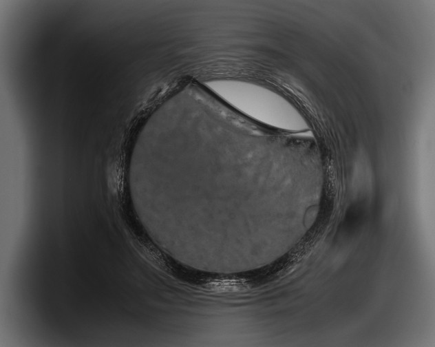 X0000097960499200803241217