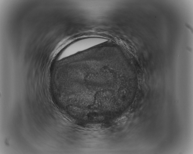 X0000097960295200804141034