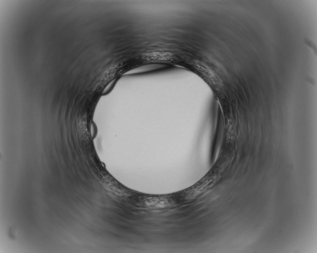 X0000097960377200804141033