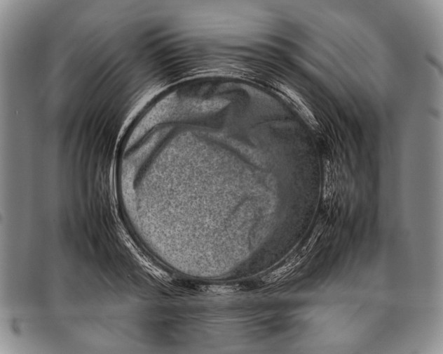 X0000097960796200804141026