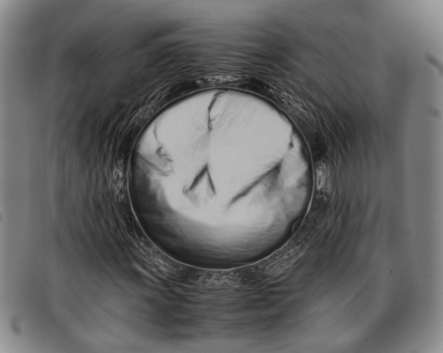 X0000097961011200804141022