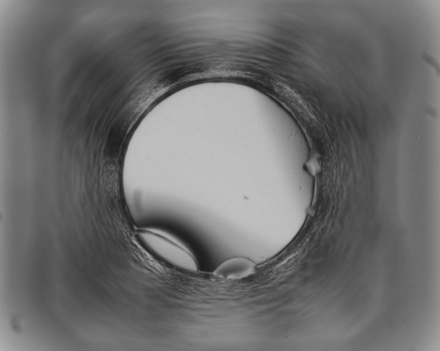 X0000097961177200804141020