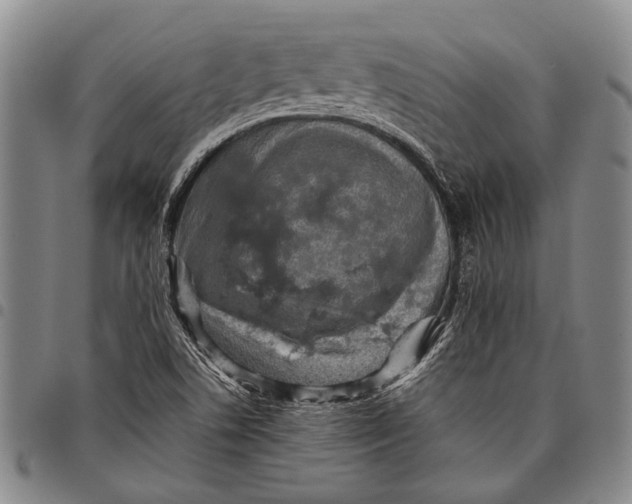 X0000097961506200804141015