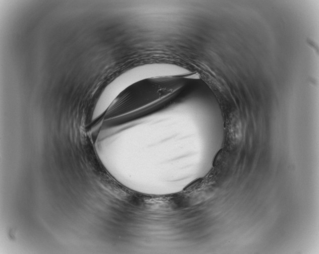 X0000097960516200804211106