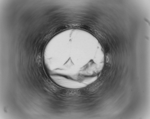 X0000097961011200804211057