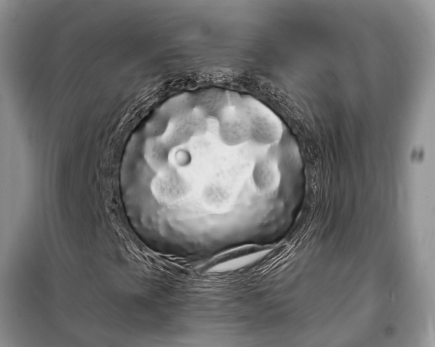 X0000097971393200804071045