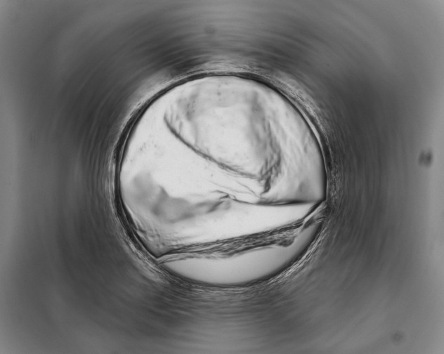 X0000097971179200804211004