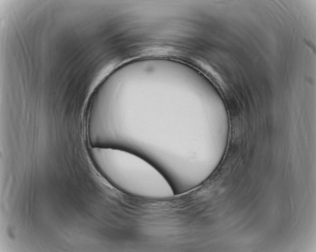 X0000097981467200803241030