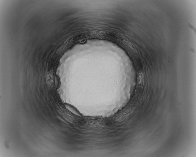 X0000097981011200804141112