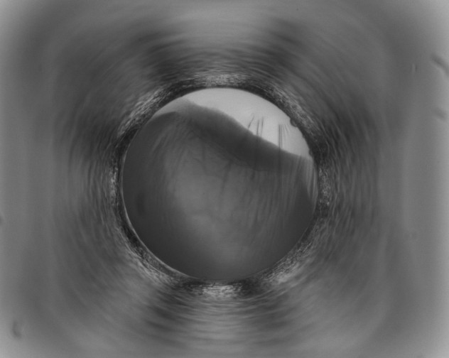 X0000097990357200804141147