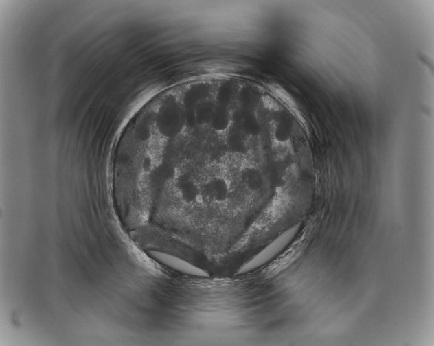 X0000097990859200804141140