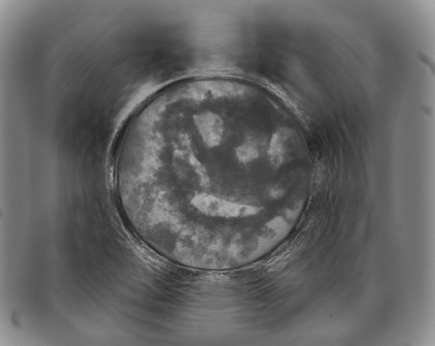 X0000097991462200804141130