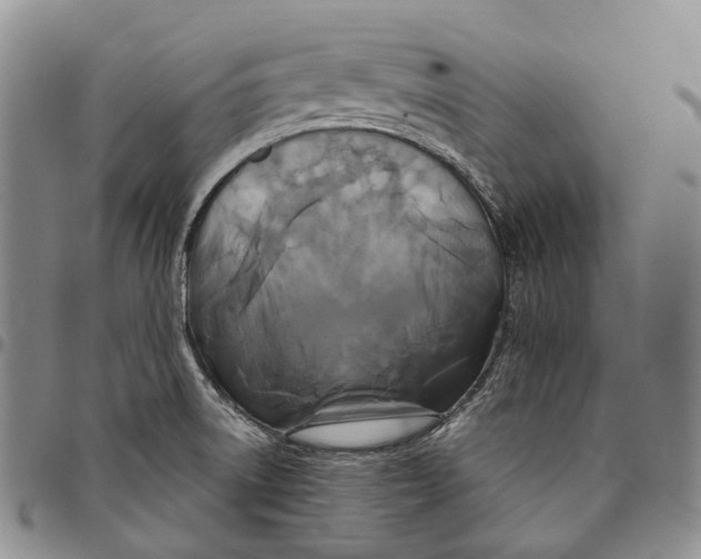 X0000097991522200804141129