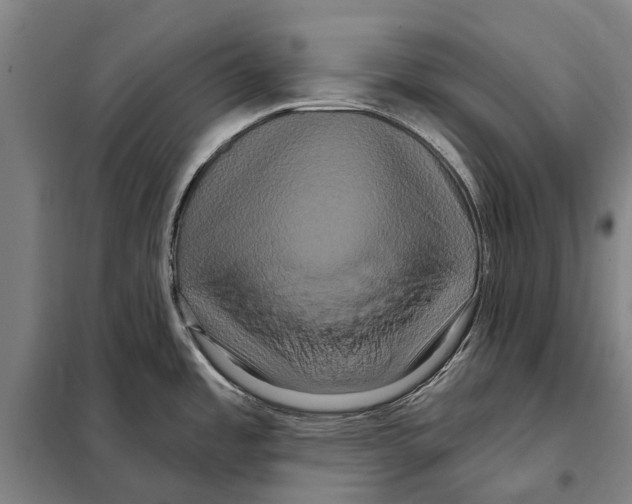 X0000097991485200804211051