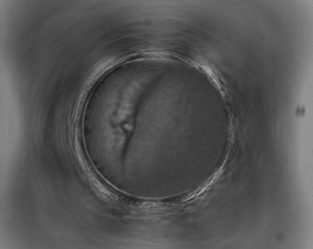 X0000098000145200804021039