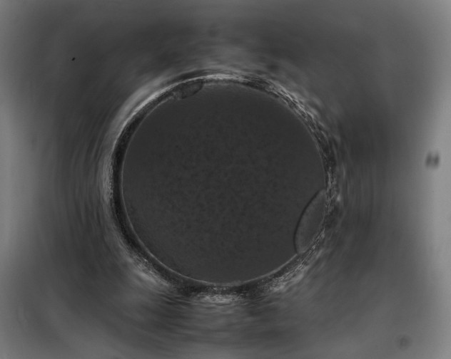 X0000098000247200804021038
