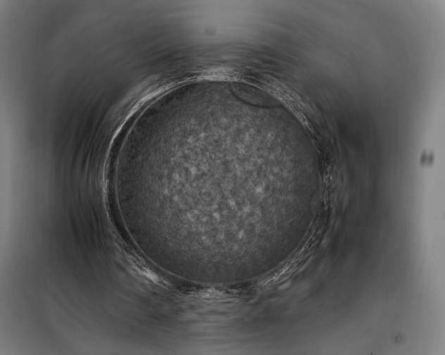 X0000098000290200804021038