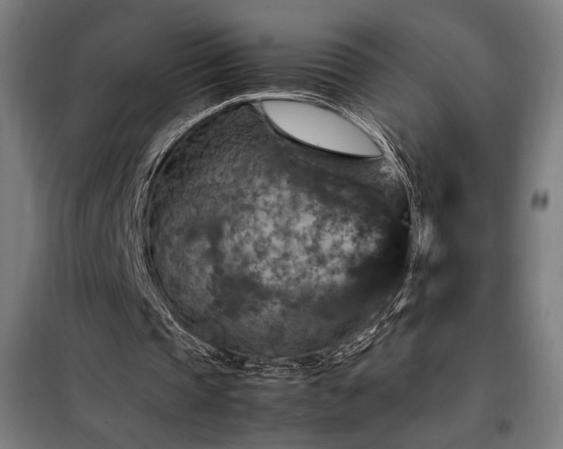 X0000098000337200804021036