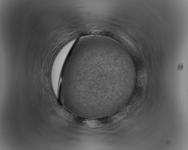 X0000098000417200804021036