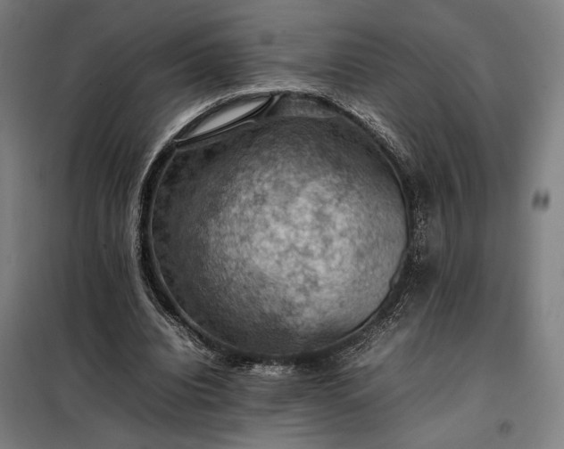 X0000098000440200804021035