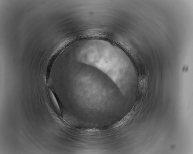 X0000098000158200804071227