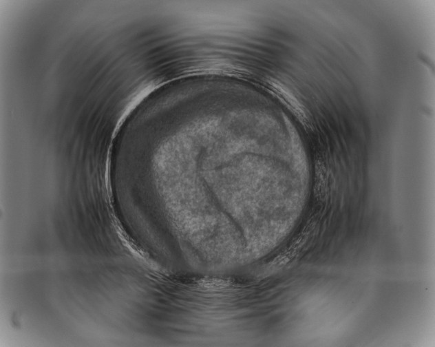 X0000098000788200804141206