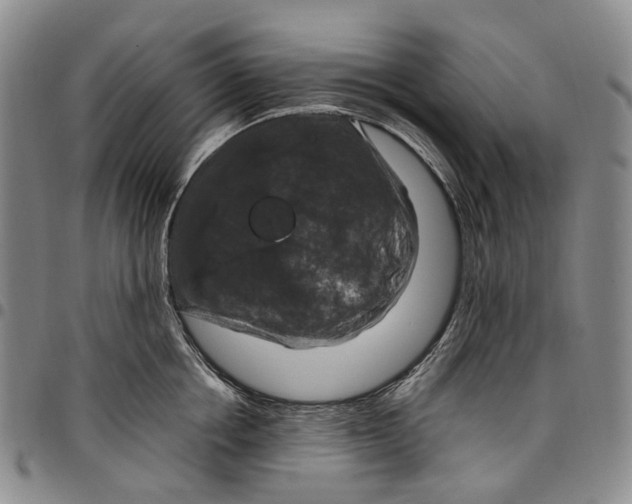 X0000098000858200804141205