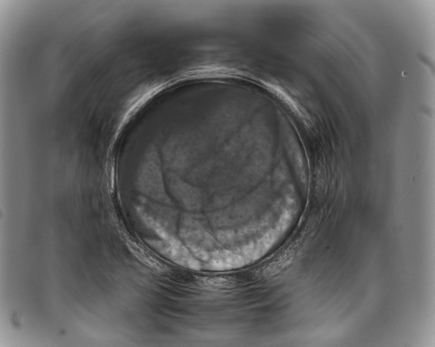 X0000098001413200804141155