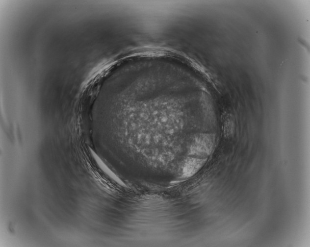X0000098001448200804141155