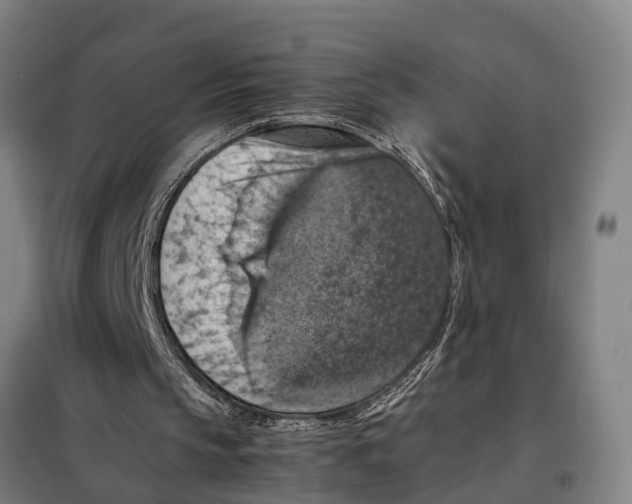 X0000098000145200804211140