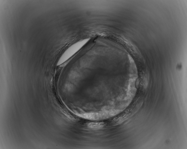 X0000098000465200804211136