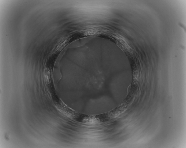 X0000098010503200803281315