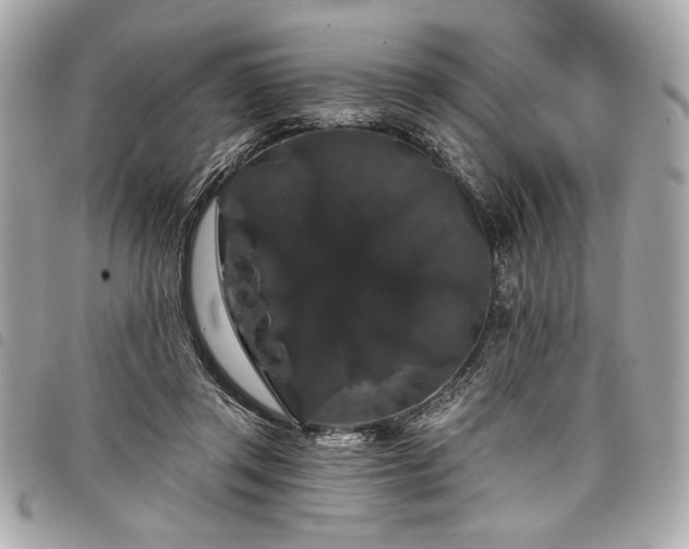 X0000098010357200804071333