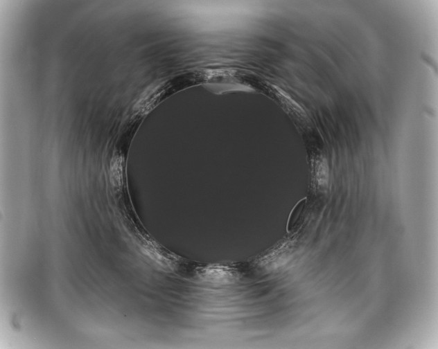 X0000098010475200804071332