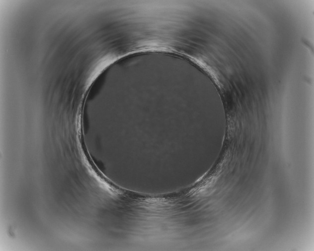 X0000098011383200804071317