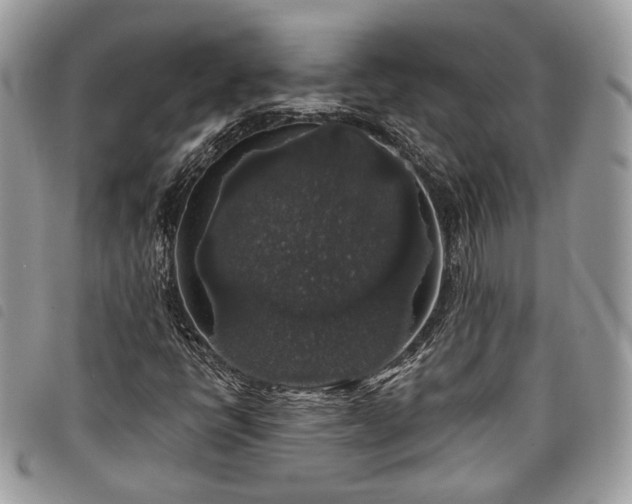 X0000098011398200804071316