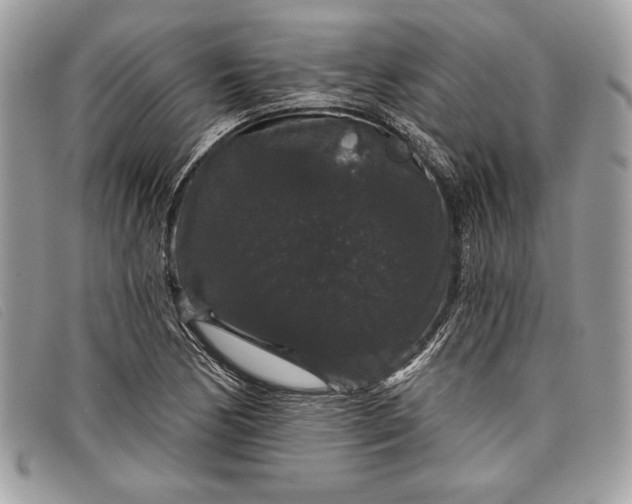 X0000098011170200804111225