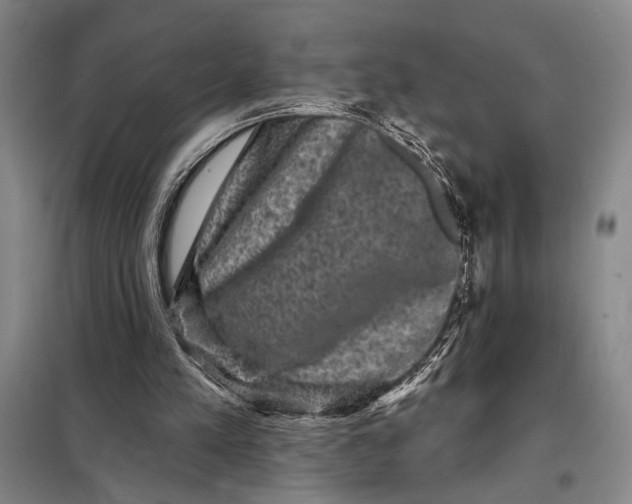 X0000098010197200804181145